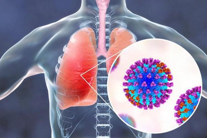 COVID-19 có thể gây tổn thương phổi kéo dài - 1