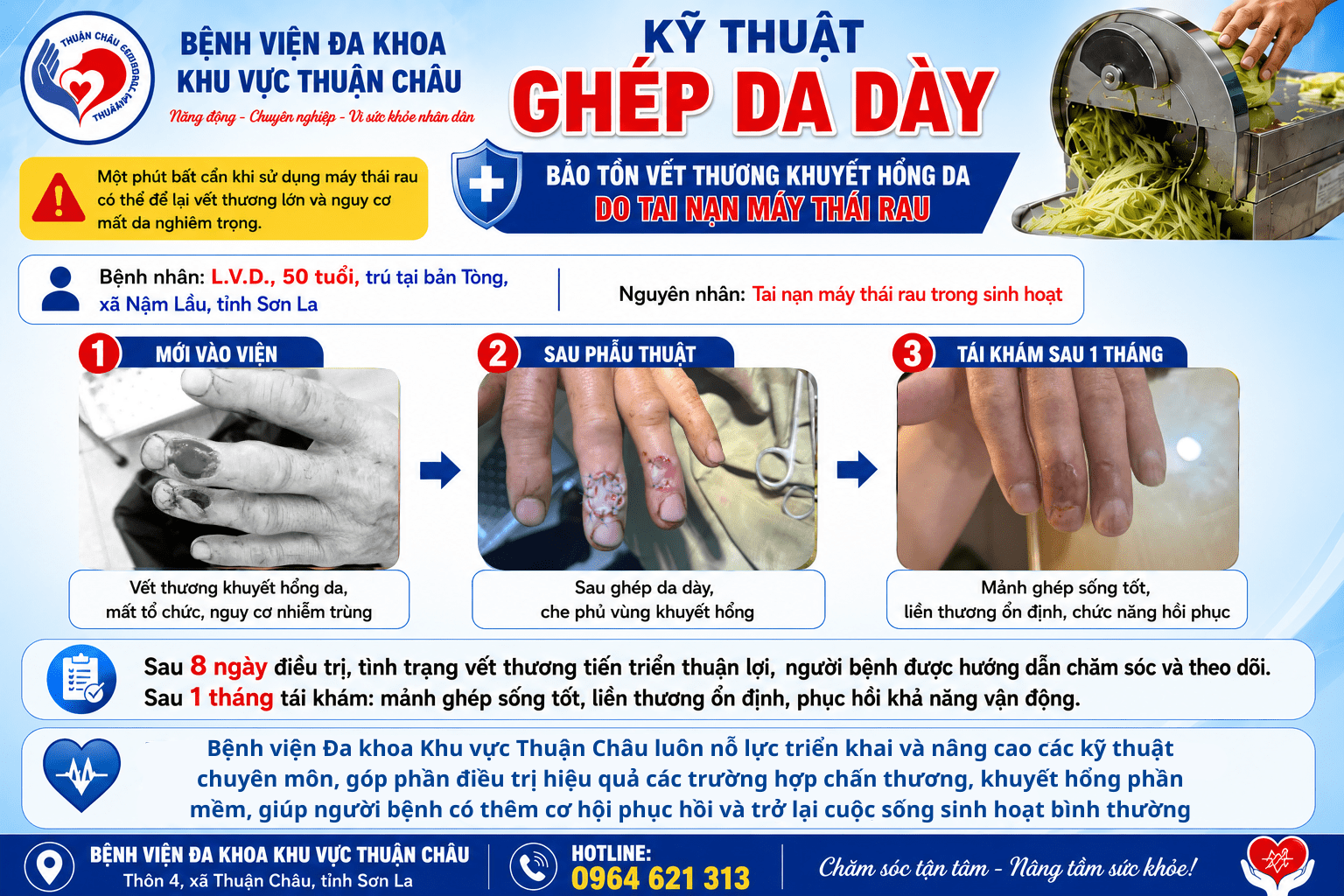 GHEP_DA_DAY_b9d1fc1ad2